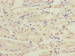 RAB4B Antibody in Immunohistochemistry (Paraffin) (IHC (P))