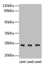 RAB4B Antibody in Western Blot (WB)