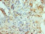 RAD51D Antibody in Immunohistochemistry (Paraffin) (IHC (P))