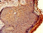 RCBTB2 Antibody in Immunohistochemistry (Paraffin) (IHC (P))