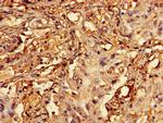 RCBTB2 Antibody in Immunohistochemistry (Paraffin) (IHC (P))