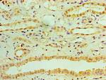 RDH11 Antibody in Immunohistochemistry (Paraffin) (IHC (P))