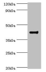 RGS20 Antibody in Western Blot (WB)