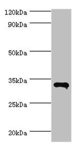 RNF212 Antibody in Western Blot (WB)