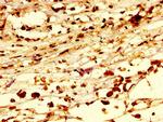 C13orf7 Antibody in Immunohistochemistry (Paraffin) (IHC (P))