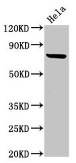 C13orf7 Antibody in Western Blot (WB)