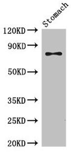 SCIN Antibody in Western Blot (WB)