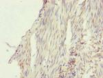 SFI1 Antibody in Immunohistochemistry (Paraffin) (IHC (P))