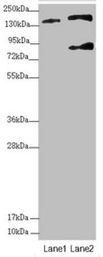 SFI1 Antibody in Western Blot (WB)