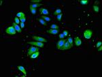 VMAT2 Antibody in Immunocytochemistry (ICC/IF)