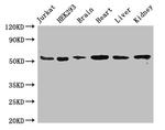 VMAT2 Antibody in Western Blot (WB)