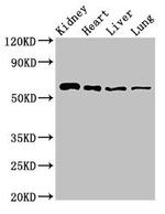 SLC22A2 Antibody in Western Blot (WB)