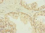 SQRDL Antibody in Immunohistochemistry (Paraffin) (IHC (P))