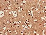 SRR Antibody in Immunohistochemistry (Paraffin) (IHC (P))