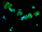 TAT Antibody in Immunocytochemistry (ICC/IF)