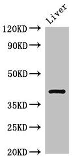 TGDS Antibody in Western Blot (WB)