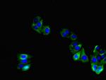 TNMD Antibody in Immunocytochemistry (ICC/IF)