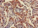 TPST1 Antibody in Immunohistochemistry (Paraffin) (IHC (P))