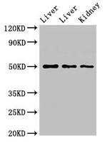 TPST1 Antibody in Western Blot (WB)