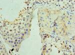 UCP1 Antibody in Immunohistochemistry (Paraffin) (IHC (P))