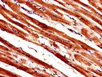 WISP1 Antibody in Immunohistochemistry (Paraffin) (IHC (P))