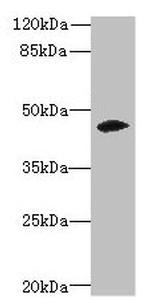 ZSCAN9 Antibody in Western Blot (WB)