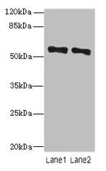 ZNF689 Antibody in Western Blot (WB)