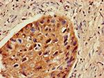 ZNF695 Antibody in Immunohistochemistry (Paraffin) (IHC (P))