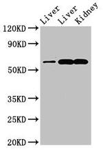 ZNF695 Antibody in Western Blot (WB)