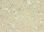 ZNF699 Antibody in Immunohistochemistry (Paraffin) (IHC (P))