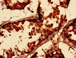 p21 ARC Antibody in Immunohistochemistry (Paraffin) (IHC (P))