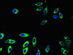 FCGR2A Antibody in Immunocytochemistry (ICC/IF)