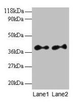 SCAMP3 Antibody in Western Blot (WB)