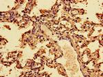 Interferon alpha-2 Antibody in Immunohistochemistry (Paraffin) (IHC (P))