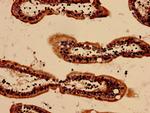 SAA Antibody in Immunohistochemistry (Paraffin) (IHC (P))