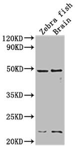 EGFR Antibody in Western Blot (WB)