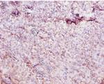 CES1 Antibody in Immunohistochemistry (Paraffin) (IHC (P))