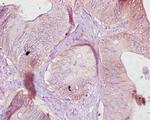 CES1 Antibody in Immunohistochemistry (Paraffin) (IHC (P))