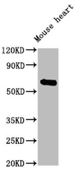 CES1 Antibody in Western Blot (WB)