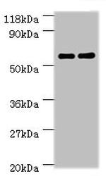 CES1 Antibody in Western Blot (WB)