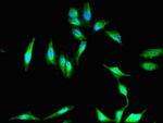 PKHD1 Antibody in Immunocytochemistry (ICC/IF)