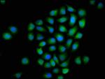 MTMR2 Antibody in Immunocytochemistry (ICC/IF)