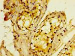 MTMR2 Antibody in Immunohistochemistry (Paraffin) (IHC (P))