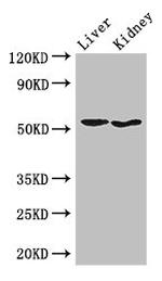 SNX17 Antibody in Western Blot (WB)