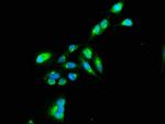 TNIP1 Antibody in Immunocytochemistry (ICC/IF)