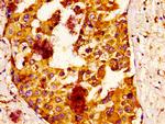 IQCB1 Antibody in Immunohistochemistry (Paraffin) (IHC (P))