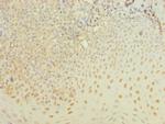 ZBTB6 Antibody in Immunohistochemistry (Paraffin) (IHC (P))