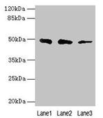 ZBTB6 Antibody in Western Blot (WB)