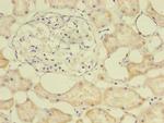 E2F2 Antibody in Immunohistochemistry (Paraffin) (IHC (P))