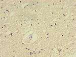 E2F2 Antibody in Immunohistochemistry (Paraffin) (IHC (P))